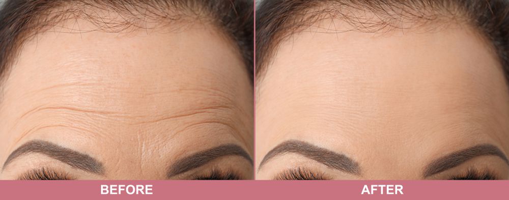 CELIMAX Vita A Retinal Shot Tightening Booster 15ml – Advanced Anti-Aging & Firming Serum