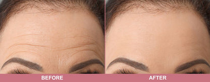 CELIMAX Vita A Retinal Shot Tightening Booster 15ml – Advanced Anti-Aging & Firming Serum