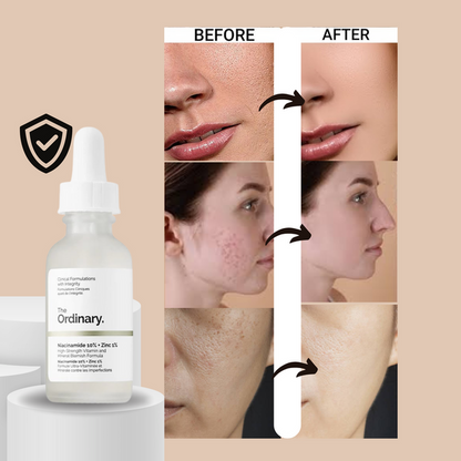 The Ordinary Niacinamide 10% + Zinc 1% - 30ml